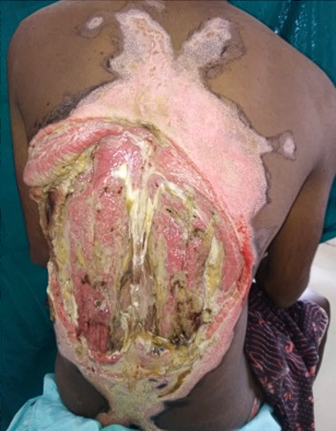 Before Surgery